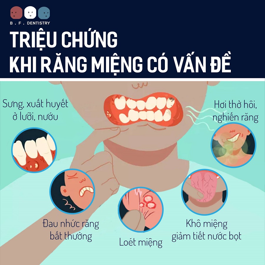 n=Những triệu chứng răng miệng
