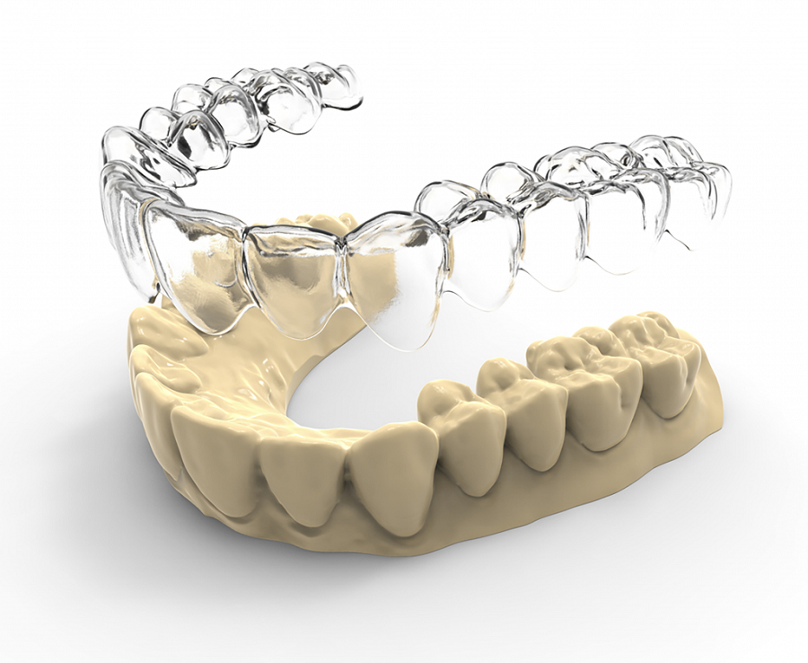 Nha khoa BF – niềng răng không mắc cài 3D uy tín và chất lượng