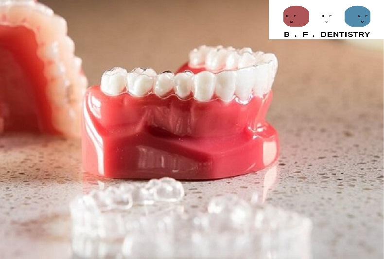 Niềng răng 3D Clear Webtretho