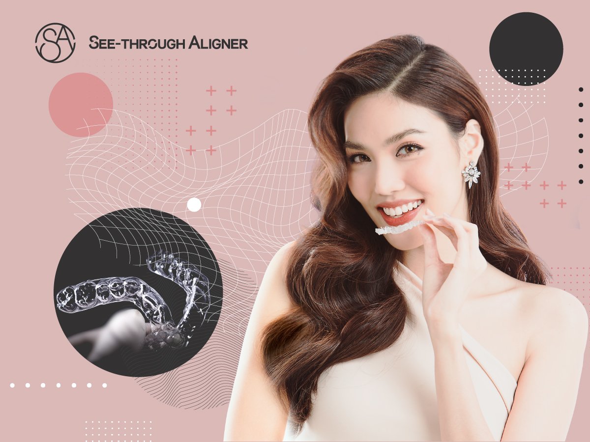 niềng răng trong suốt See through aligner