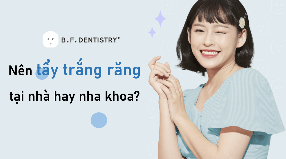 Nên tẩy trắng răng tại nhà hay nha khoa?